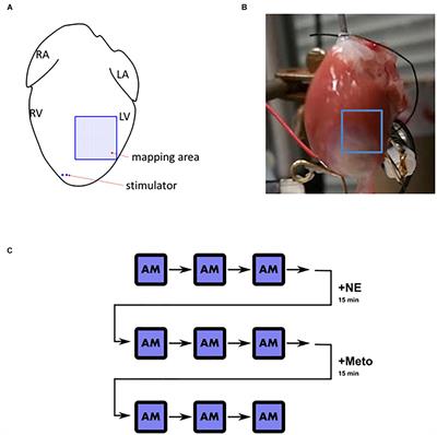 β-Adrenergic Receptor Stimulation and Alternans in the Border Zone of a Healed Infarct: An ex vivo Study and Computational Investigation of Arrhythmogenesis